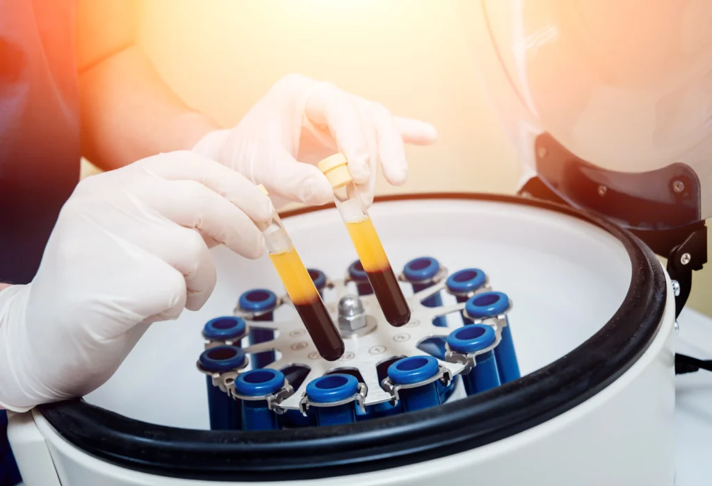 Hemoglobin Testing | Revive IV Lounge buford