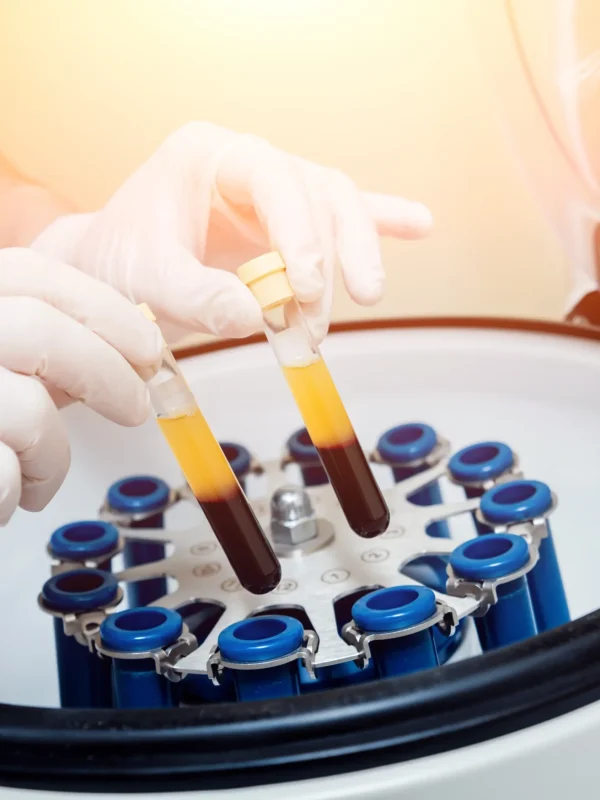 Hemoglobin Testing | Revive IV Lounge buford