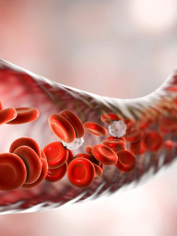 Therapeutic Phlebotomy aka | Blood Dumping Test